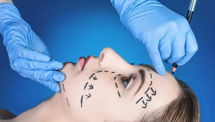 How to Prepare for Plastic Surgery in Buffalo, NY