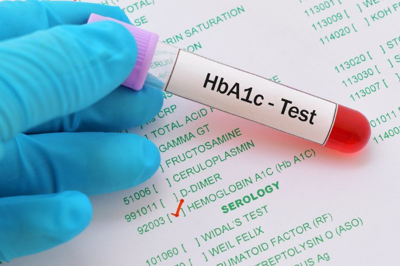 What Can An HbA1C Blood Test Tell You?