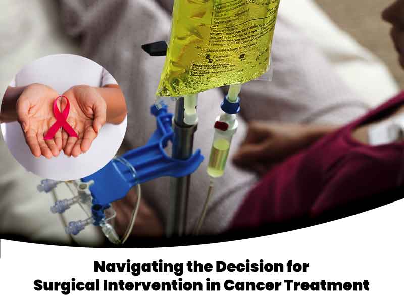 Navigating the Decision for Surgical Intervention in Cancer Treatment