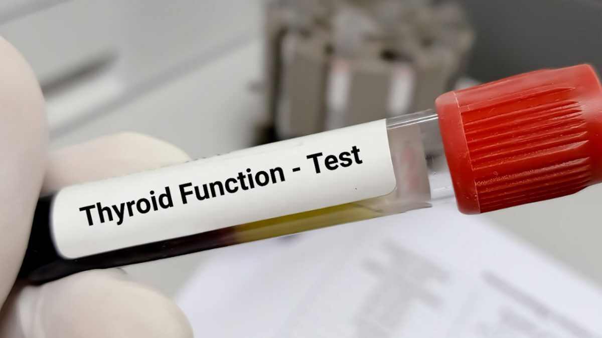Do We Need to Fast For Thyroid Test?