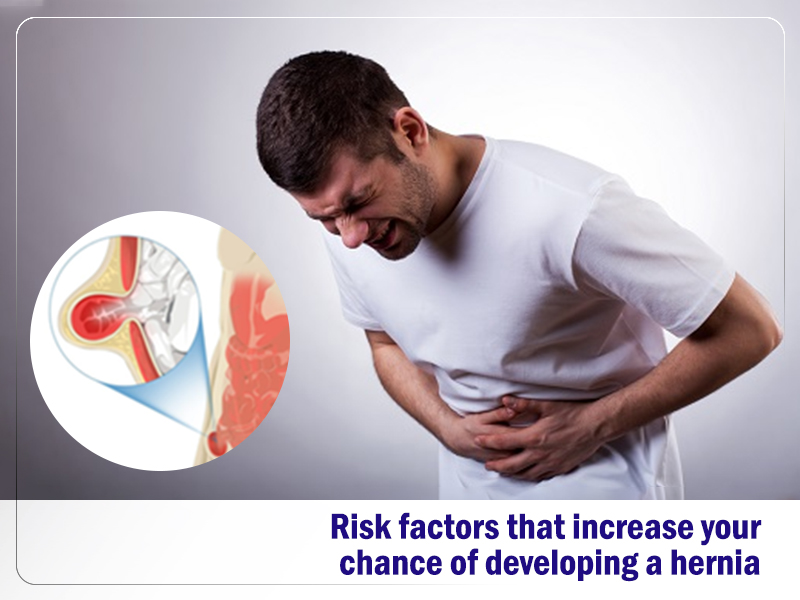 Risk factors that increase your chance of developing a hernia