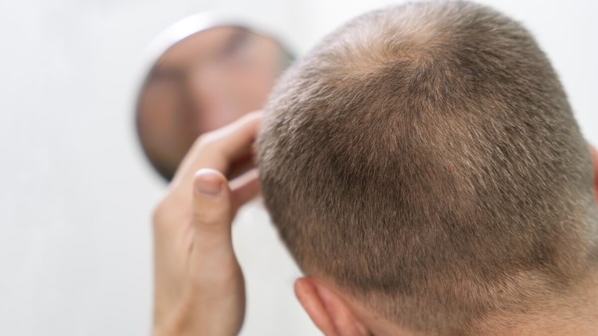 Advantages of Choosing a Specialized Hair Clinic Over General Clinics