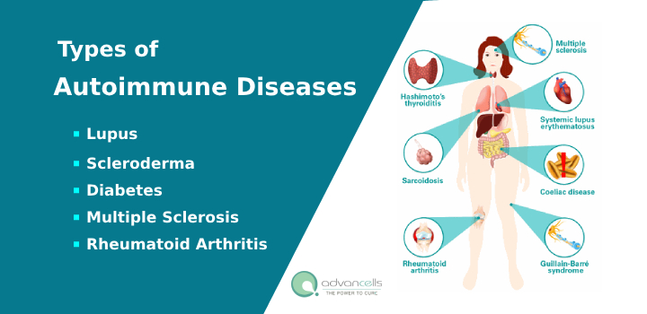 Types of Common Autoimmune Diseases