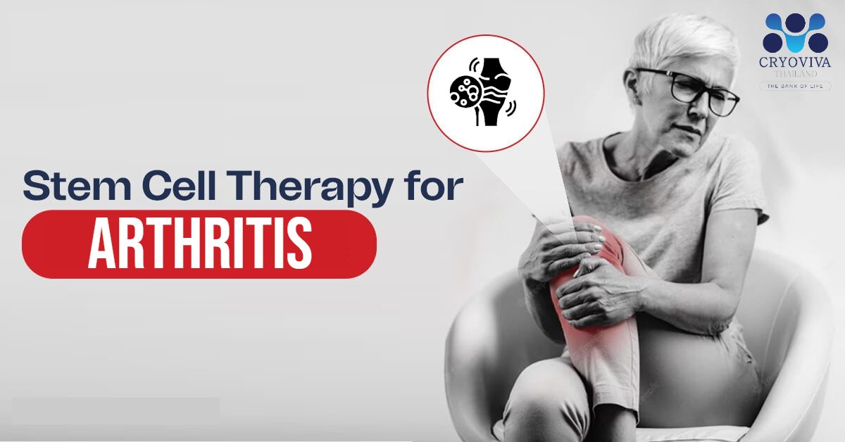 Stem Cells in Regenerative Medicine has the Potential to Cure Arthritis