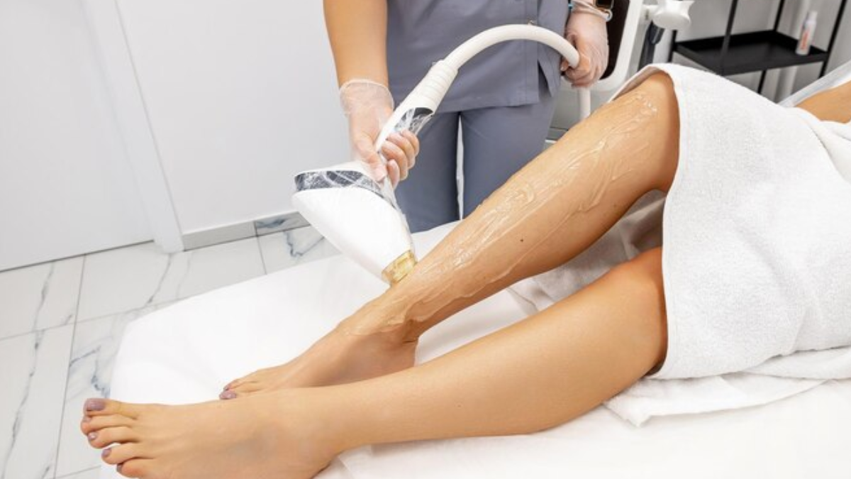 A Definitive Guide to Laser Hair Removal in Sydney: Things to Know
