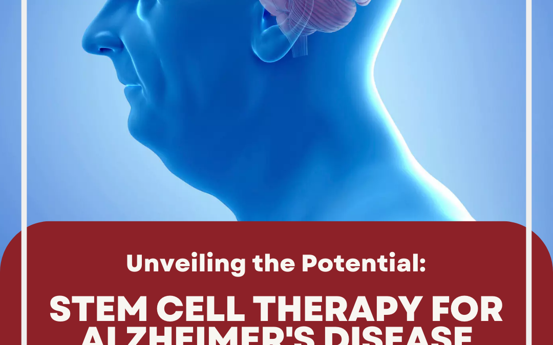 Unveiling the Potential: Stem Cell Therapy for Alzheimer’s Disease