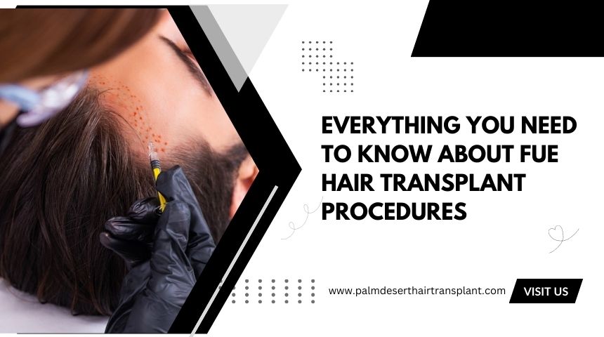 What You Need to Know About FUE Hair Transplant Procedures