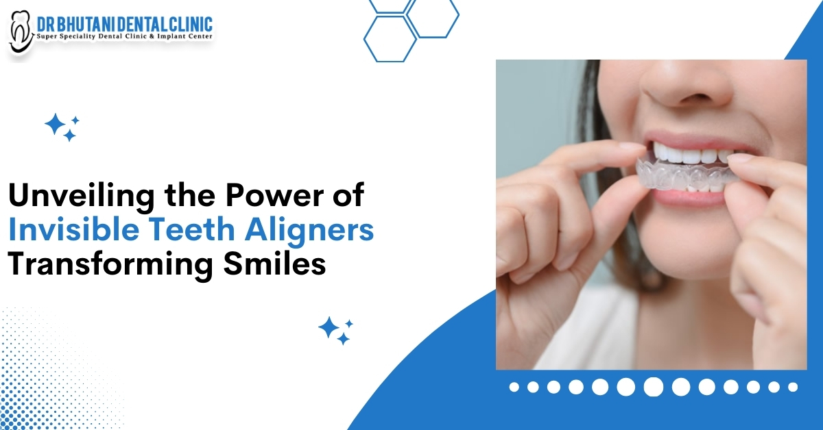 Unveiling the Power of Invisible Teeth Aligners: Transforming Smiles