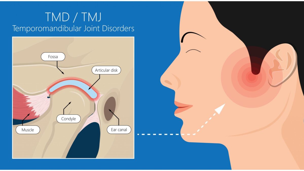 Understanding and Seeking TMJ Treatment: Impact, Benefits, and Importance